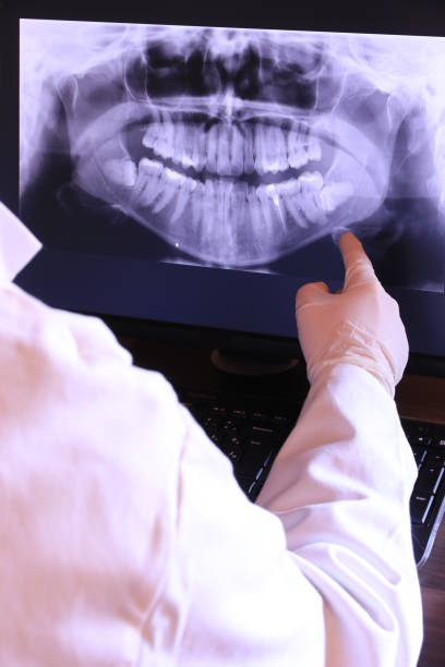 Best Tooth Infection Emergency Dentist  in Castroville, TX